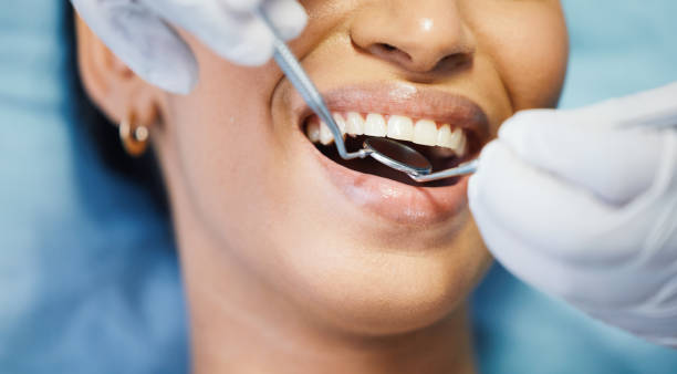 Best Chipped Tooth Repair Near Me  in Santa Clara, CA